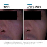 P-TIOX Anti-Wrinkle Cream