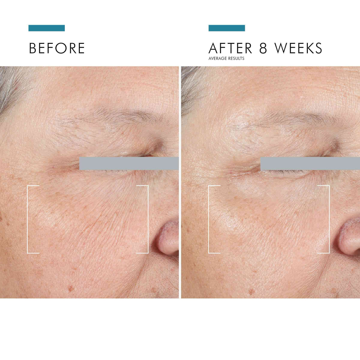 A.G.E. Advanced Eye for Dark Circles