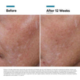 Hyaluronic Acid Intensifier Multi-Glycan